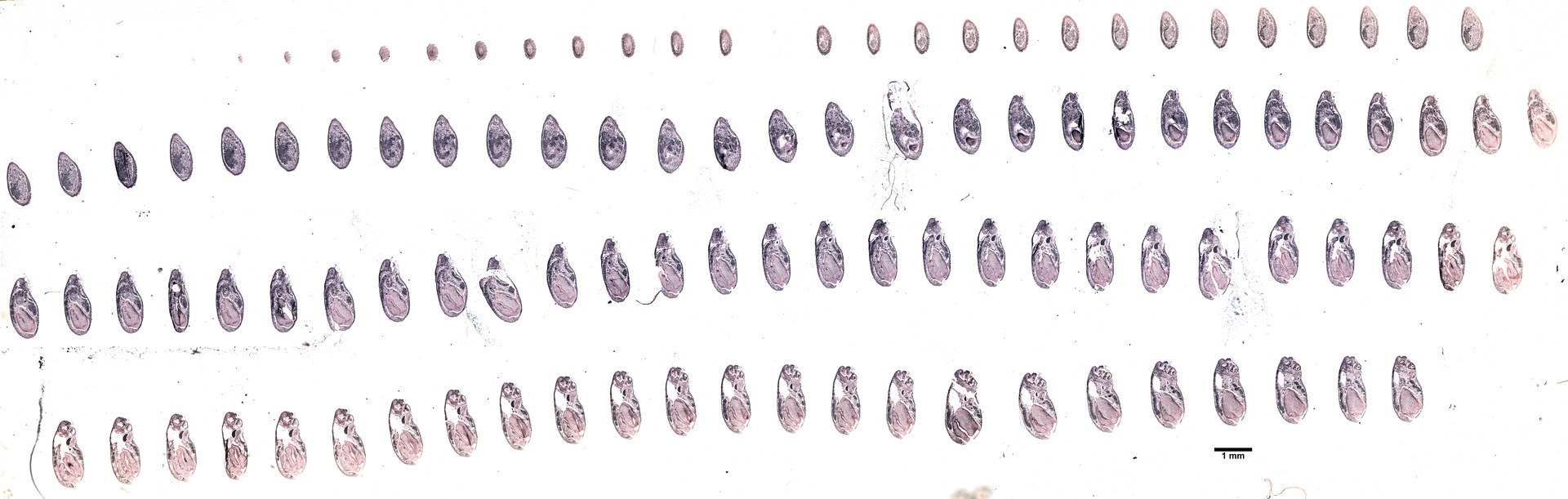 Schwarze und weiße Zeichnung einer symmetrischen Reihe von Kreisen auf einem weißen Hintergrund, wobei jeder eine Stufe in der Evolution des menschlichen Genoms darstellt.